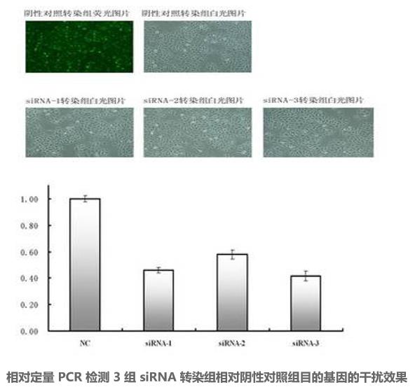 圖片21-siRNA的細胞轉(zhuǎn)染及篩選.jpg